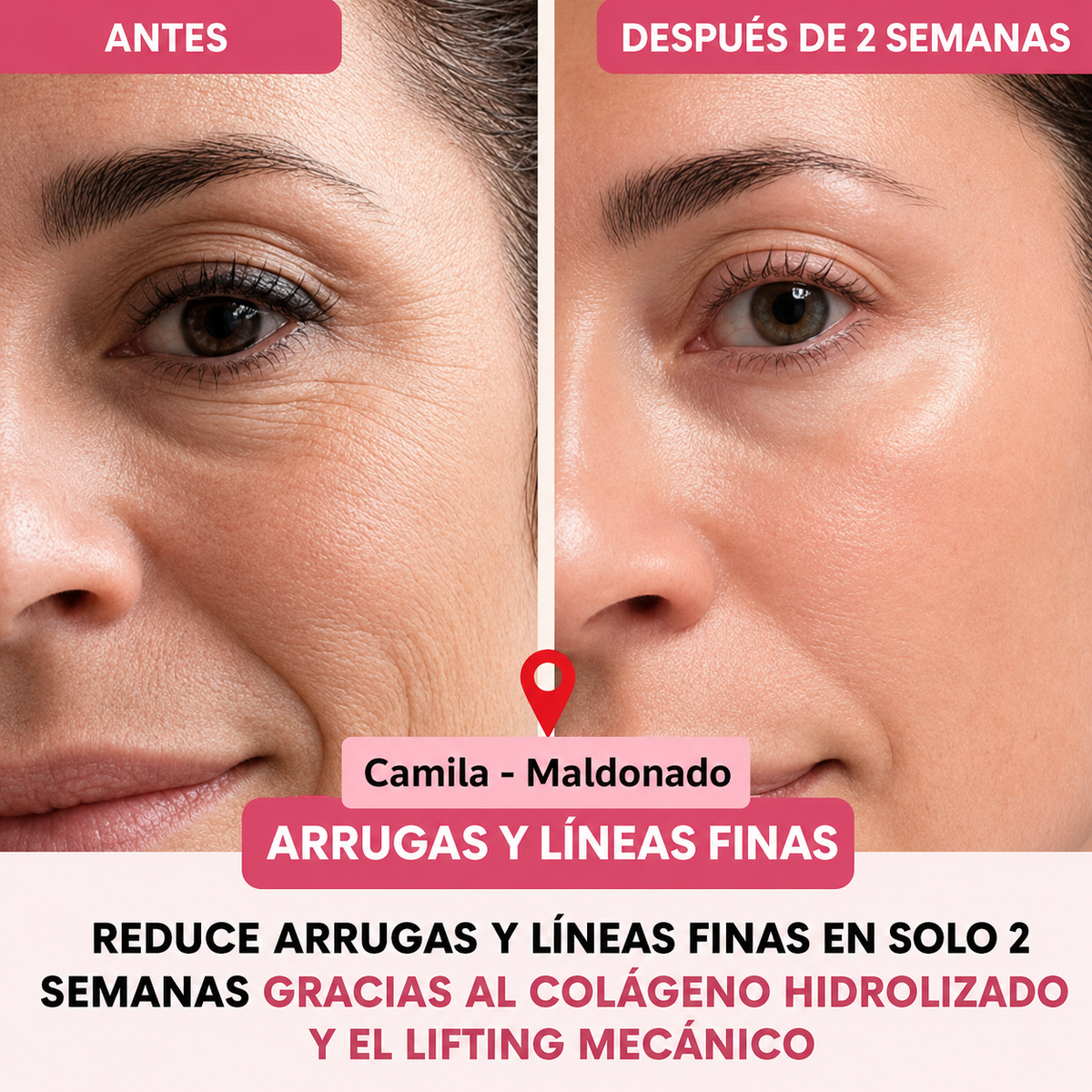 Collagen Pro™ – Máscara Facial de Colágeno Avanzado