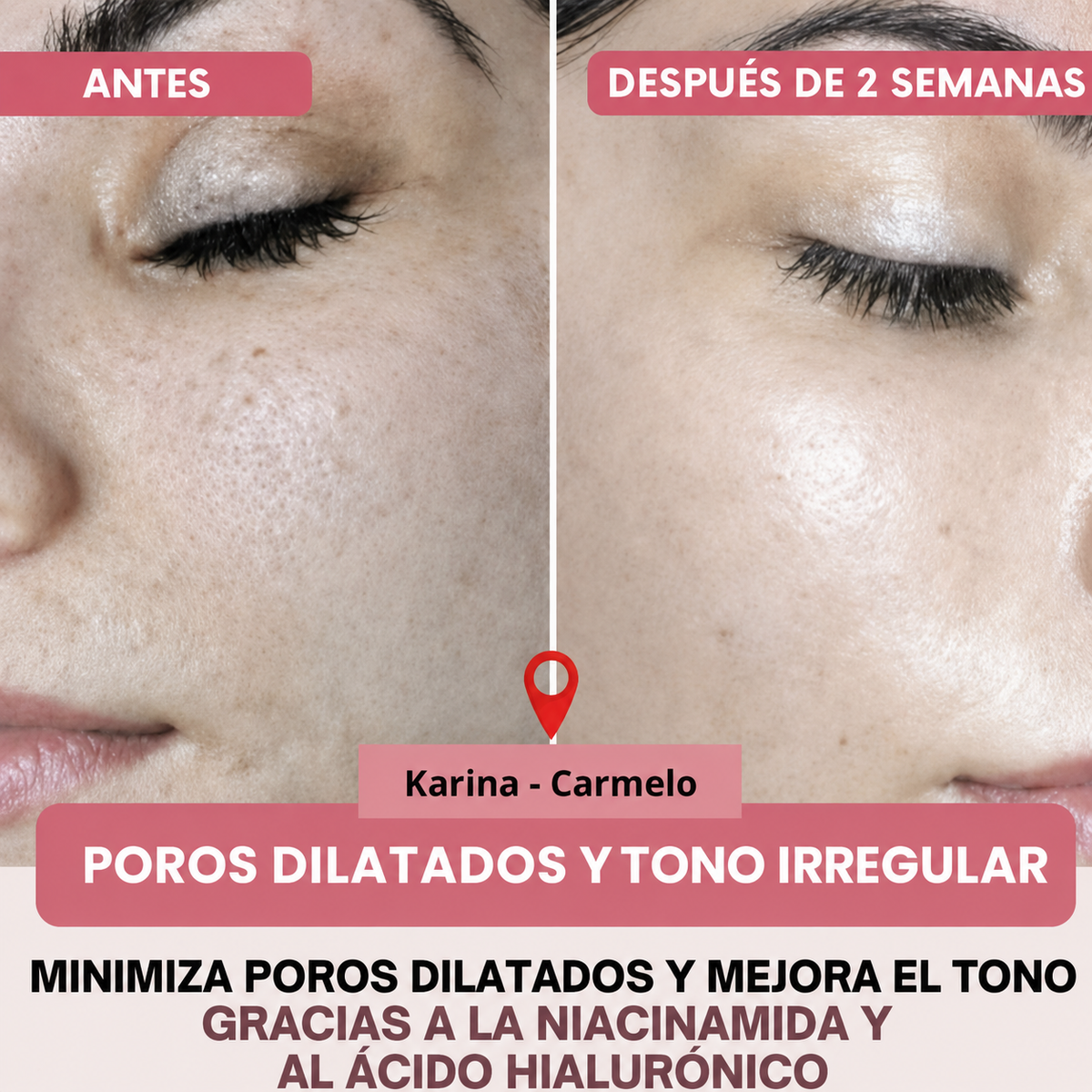 Collagen Pro™ – Máscara Facial de Colágeno Avanzado