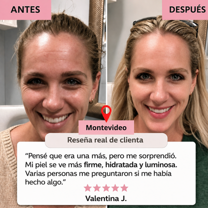 Collagen Pro™ – Máscara Facial de Colágeno Avanzado