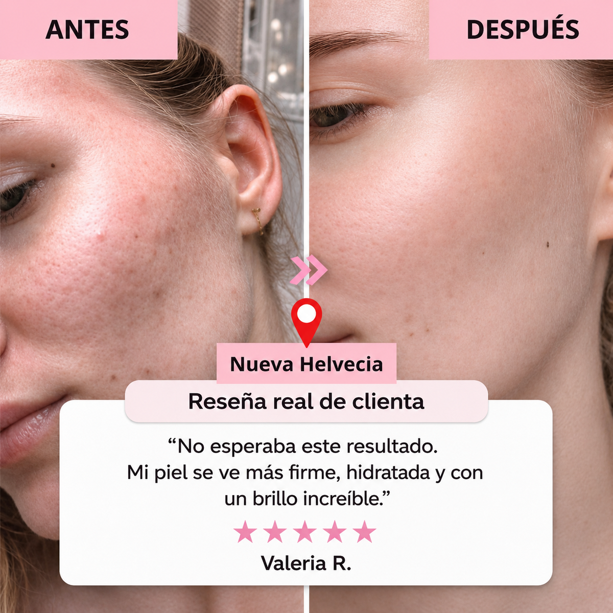 Collagen Pro™ – Máscara Facial de Colágeno Avanzado