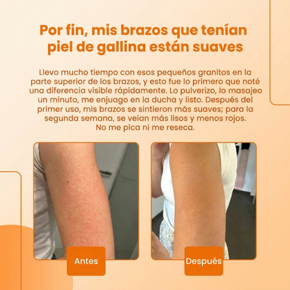 Exfoliante Corporal con Ácido Kójico y Cúrcuma